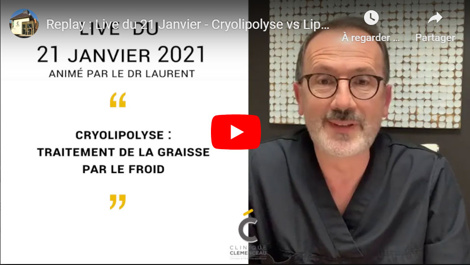 Cryolipolyse ou liposuccion ? Clinique Clémenceau à Lille