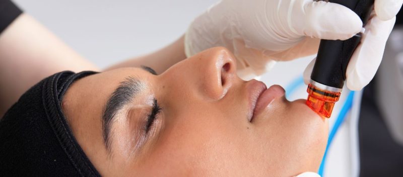 Soin HydraFacial à la Clinique Clemenceau de Lille et Arras