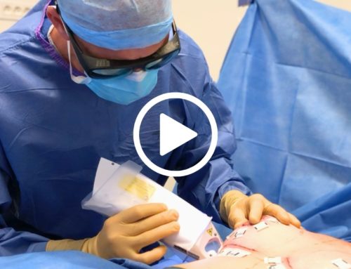 Vidéo – Le laser UrgoTouch : améliorer la cicatrice post-chirurgie